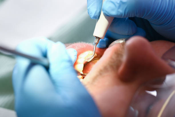 Best Emergency TMJ Treatment in Butler, AL
