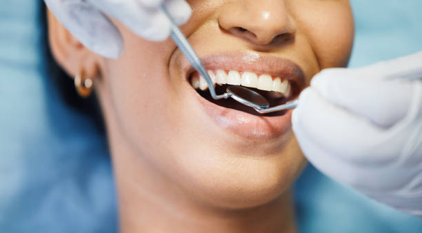 Best Cosmetic Emergency Dentistry in Butler, AL